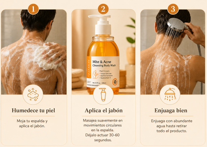 Jabon Antiacné para Espalda